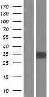 ZNF688 Protein (Over-Expression Lysate Myc-DDK (Flag))