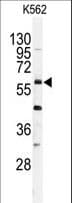USP2 Antibody (aa508-538)