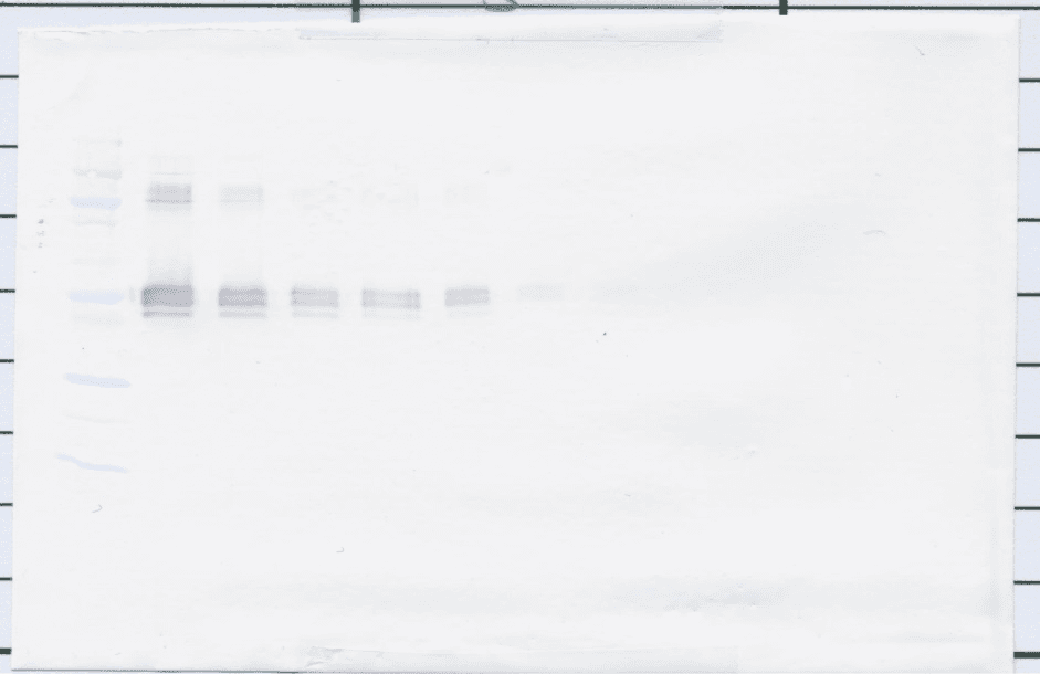 Polyclonal Rabbit anti-Human sCD14 Antibody (WB)