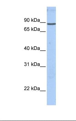 Polyclonal Rabbit anti-Human GSN / Gelsolin Antibody (aa542-591, IHC, WB)