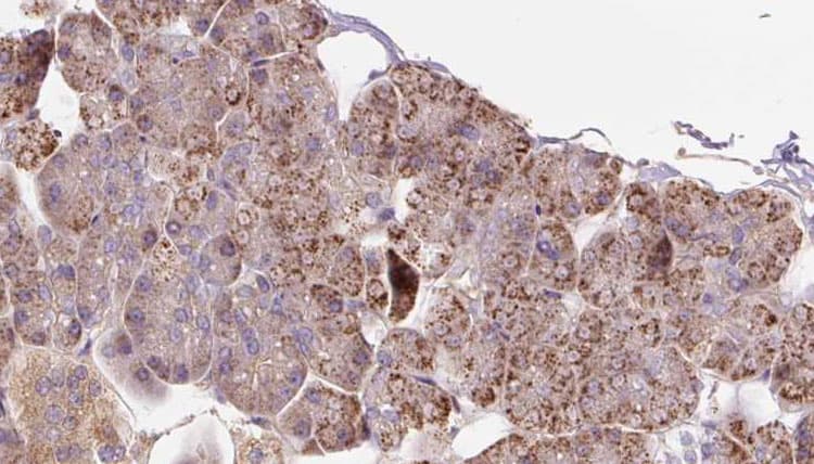 PCCA Antibody
