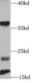 FGF2 / Basic FGF Antibody