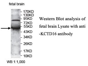 KCTD16 Antibody (aa181-347)