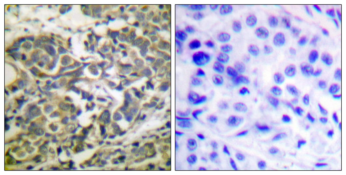 Polyclonal Rabbit anti-Human PRKAA1 + PRKAA2 Antibody (phospho-Thr172, IHC, WB)