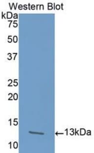 ACVR1B / ALK4 Antibody (aa24-126, PE)