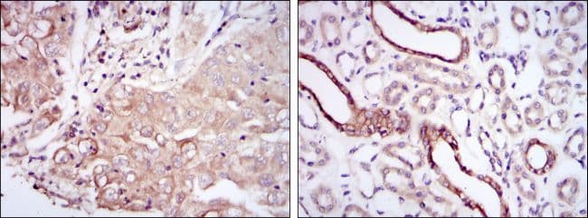 Monoclonal Mouse anti-Human PODXL / Podocalyxin Antibody (clone 5F5, IHC, WB)