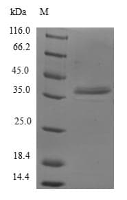 Human GTF2A2 / TFIIA Protein (Recombinant GST, N-terminus)