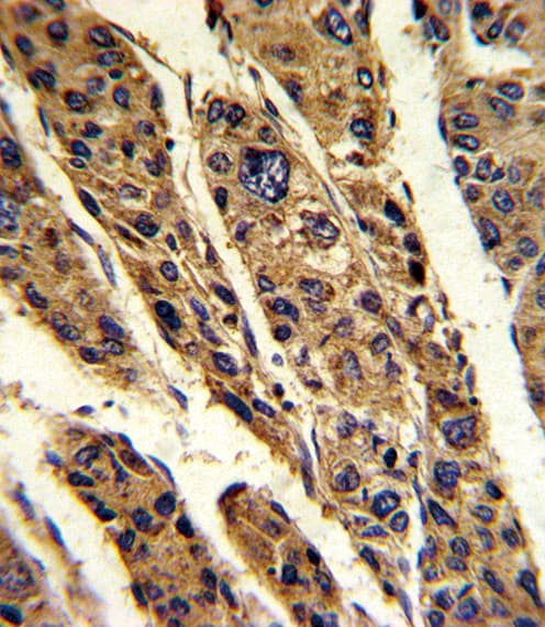 TPT1 / TCTP Antibody (aa85-113)