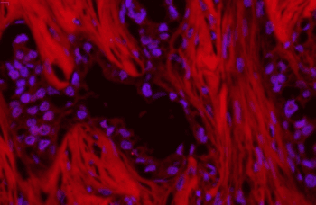 SQSTM1 Antibody