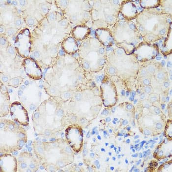 NEFH / NF-H Antibody