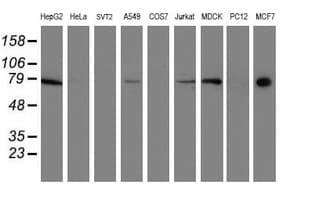 RPN1 / Ribophorin I Antibody (clone OTI6A9)
