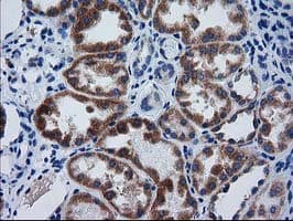 GCKR Antibody (clone OTI1E7)