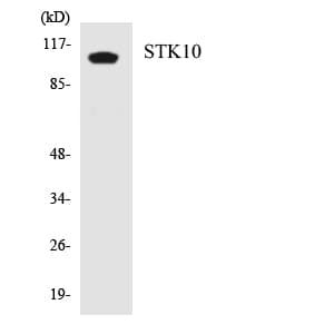 IHC-plus™ STK10 / LOK Antibody (aa481-530)