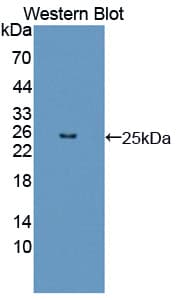 FGF12 Antibody (aa1-181, Biotin)