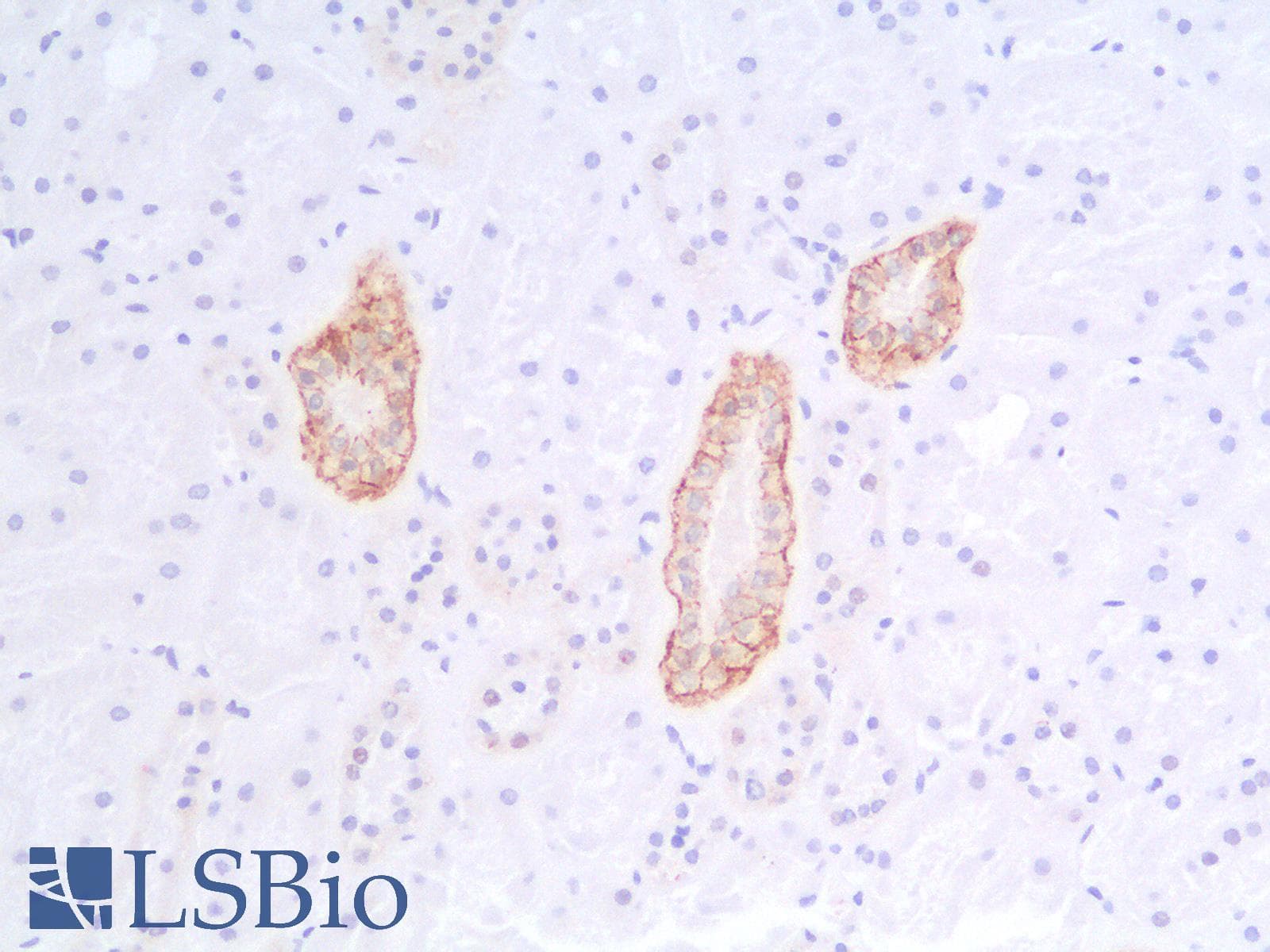 IHC-plus™ Recombinant Monoclonal Mouse anti-Human EPCAM Antibody (clone rEGP40/1110, aa 280-350, IHC)