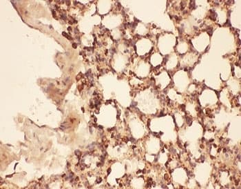 CFL1 / Cofilin Antibody (aa2-166)