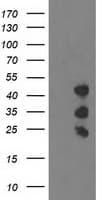 PDLIM2 / SLIM Antibody (clone OTI15C1)