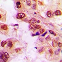 TRIP4 / ASC-1 Antibody (Internal)