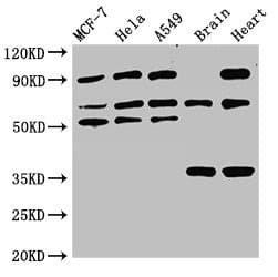 TRIM4 / RNF87 Antibody