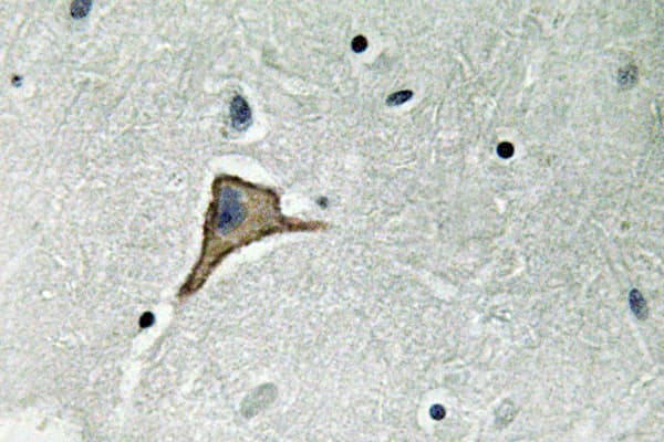 GJA1 / CX43 / Connexin 43 Antibody (Arg361)