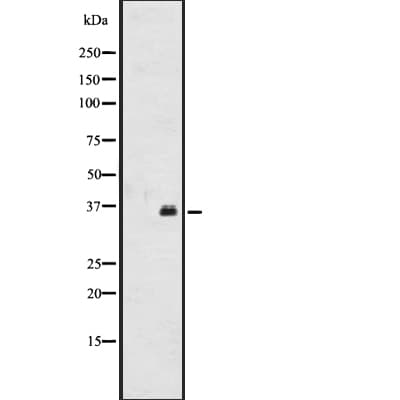 Polyclonal Rabbit anti-Human OR2A12 Antibody (IHC, WB)