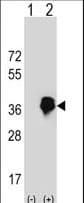Polyclonal Rabbit anti-Human MLX / TCFL4 Antibody (aa125-151, IHC, WB)