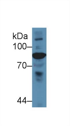 Polyclonal Rabbit anti-Chicken Complement C4 Antibody (aa1428-1660, WB)