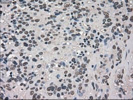 TRIB2 Antibody (clone OTI8D11)