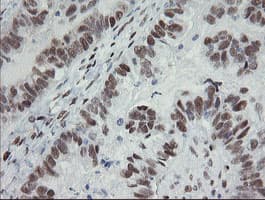 TLE1 / TLE 1 Antibody (aa180-460, clone OTI1F9)