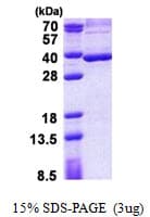 Human STC2 / Stanniocalcin 2 Protein (Recombinant His)