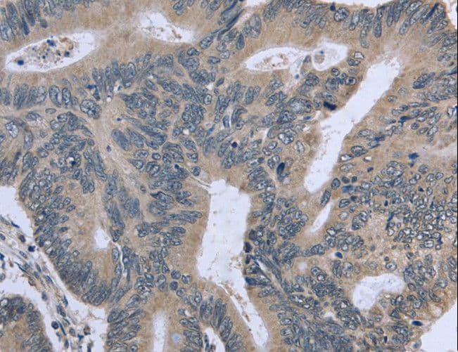 ETK / BMX Antibody