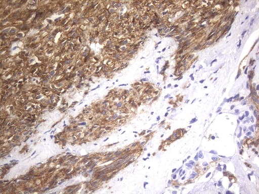 c-Kit / CD117 Antibody (aa27-308, clone UMAB216)