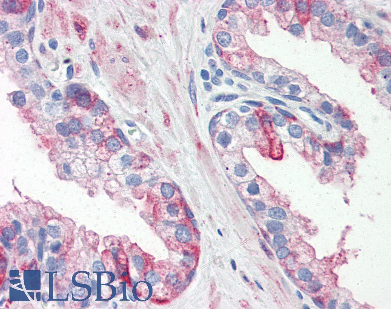 IHC-plus™ Monoclonal Mouse anti-Human HSPB1 / HSP27 Antibody (clone 2A5, aa1-205, IHC, WB)