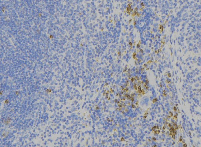 ADGRG1 / GPR56 Antibody