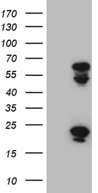 Monoclonal Mouse anti-Human TYW2 / TRMT12 Antibody (clone OTI1C12, Carrier-free, WB)