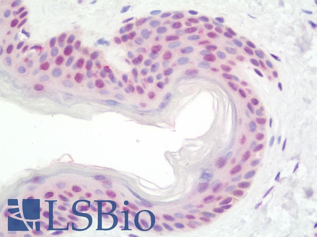 IHC-plus™ TERT / Telomerase Antibody (aa627-656)