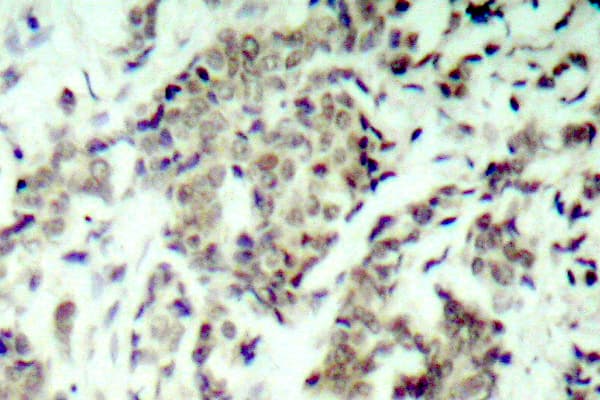 TP53 / p53 Antibody (Ser9)