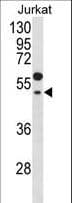 Polyclonal Rabbit anti-Human GNAT1 Antibody (aa290-318, IHC, WB)