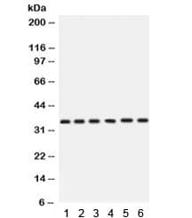 Polyclonal Rabbit anti-Human CDK4 Antibody (IHC, WB)