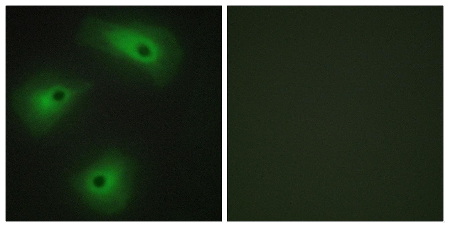 ANO1 / DOG1 / TMEM16A Antibody