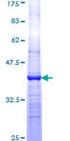 Human GPC3 / Glypican 3 Protein (Recombinant GST, N-terminus)