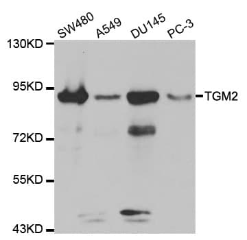 TGM2 / Transglutaminase 2 Antibody