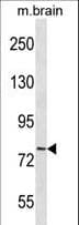 CDH11 / Cadherin 11 Antibody (aa622-650)