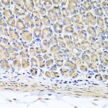 STK3 Antibody