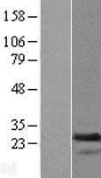 TAGLN2 / Transgelin 2 Protein (Over-Expression Lysate Myc-DDK (Flag))