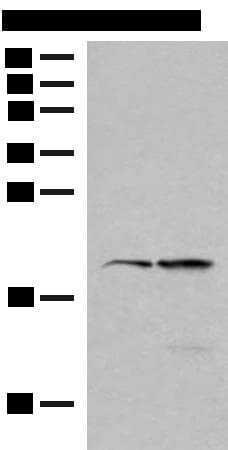 RMA1 / RNF5 Antibody