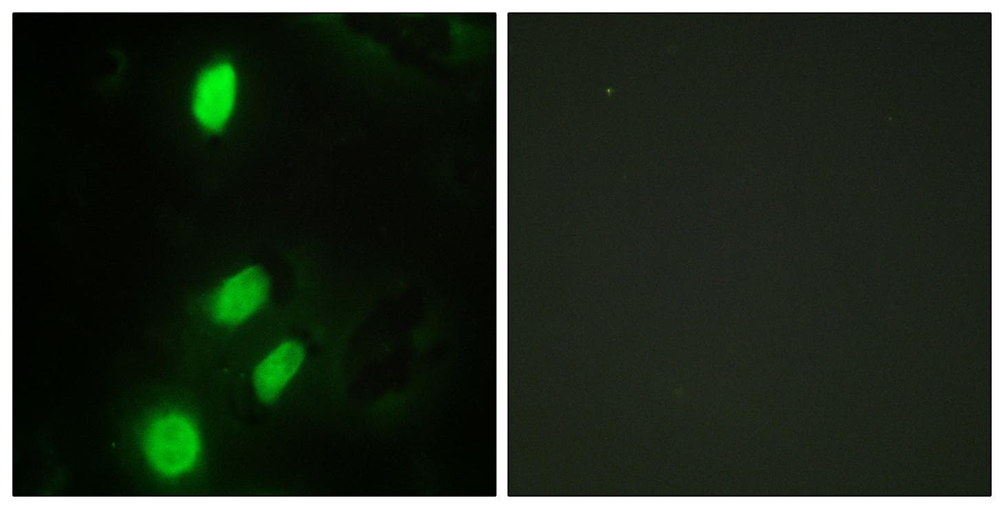 ETV6 / TEL Antibody