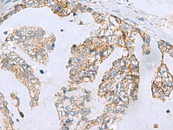 MGME1 / C20orf72 Antibody