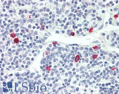 IHC-plus™ IL4 Antibody