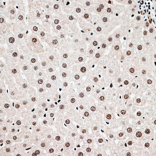 CBX6 Antibody